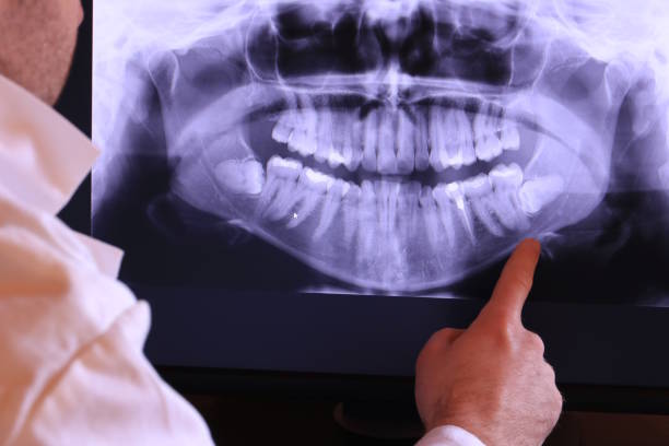 Best Emergency Treatment for Dental Infections or Abscesses in Etna, PA